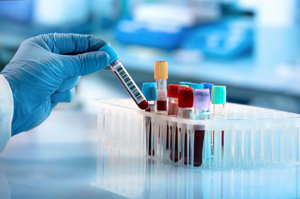 Doctor,Hand,Taking,A,Blood,Sample,Tube,From,A,Rack, Blod