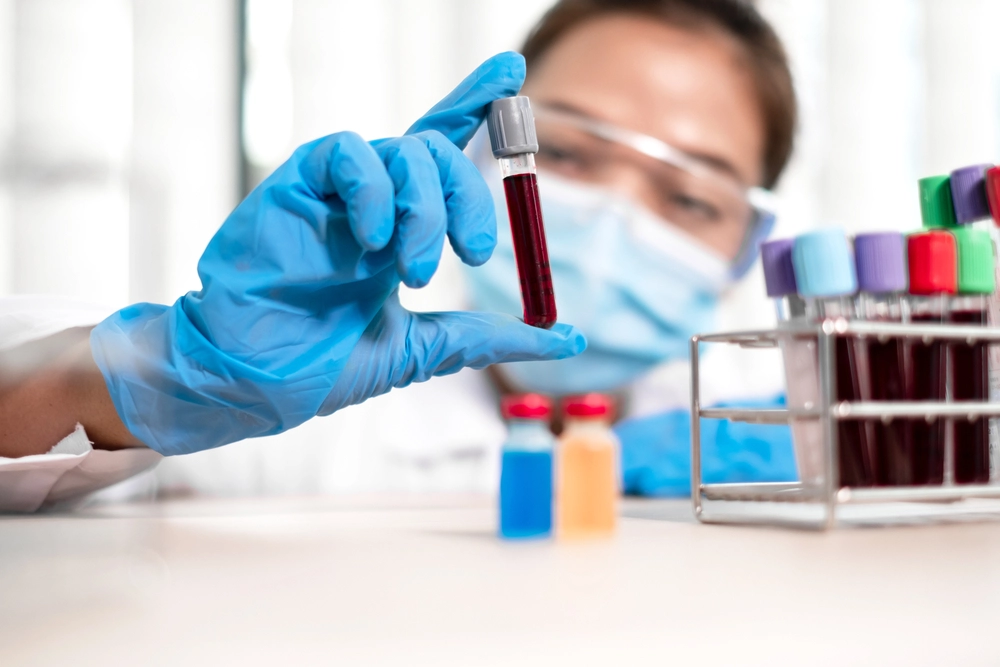 Professional,Doctors,Perform,Find,Virus,Tests,From,Samples,Of,Blood