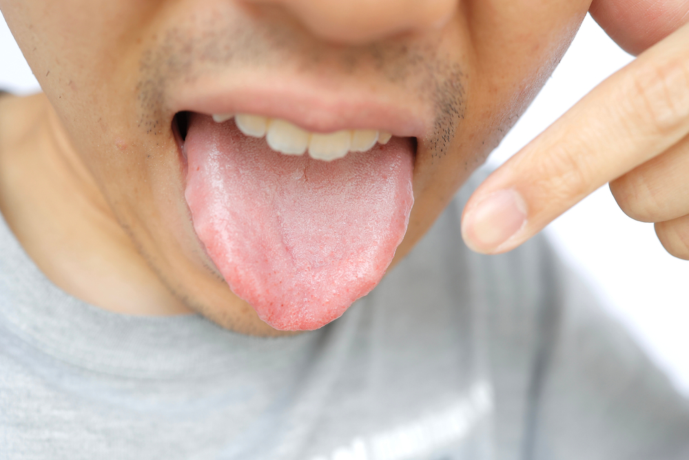 Male tongue