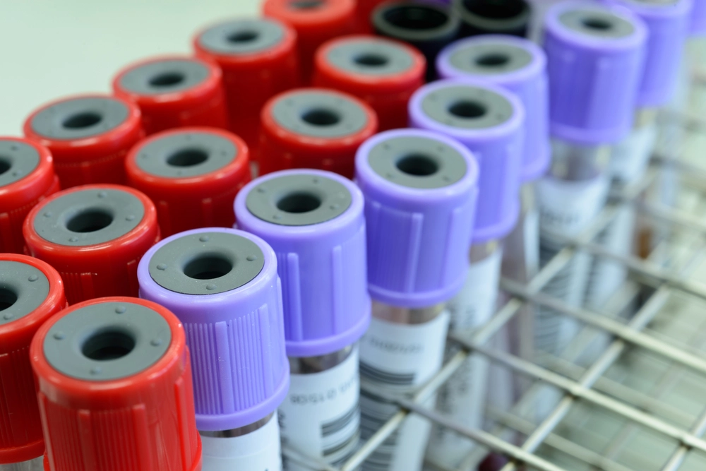 Close,Up,Medical,Test-tube,With,Blood,Samples, Blod,