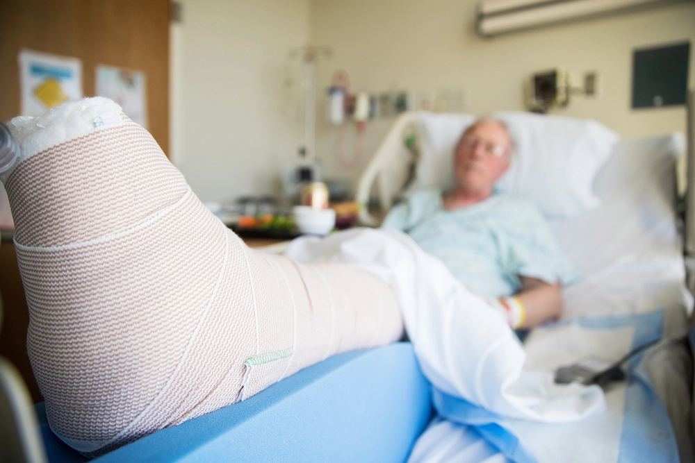 Old person with broken leg in hospital bed / gammel person med br&aelig;kket ben i hospitalsseng