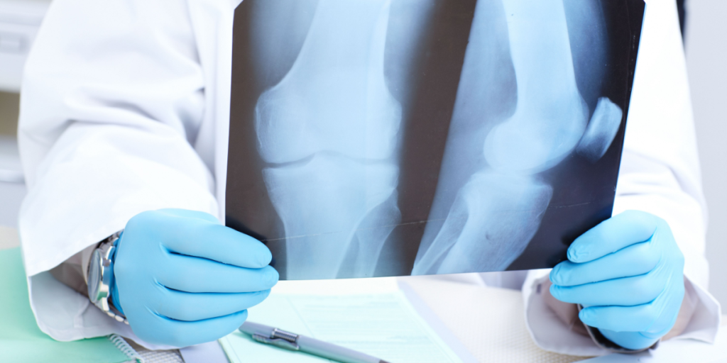 X-ray, bones