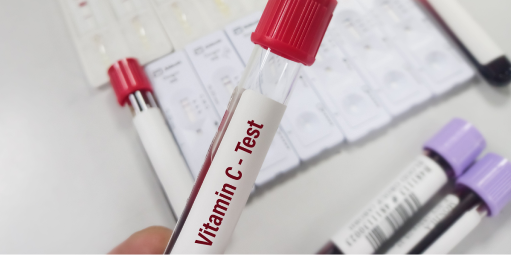 Blood sample, blodprøve, c vitamin