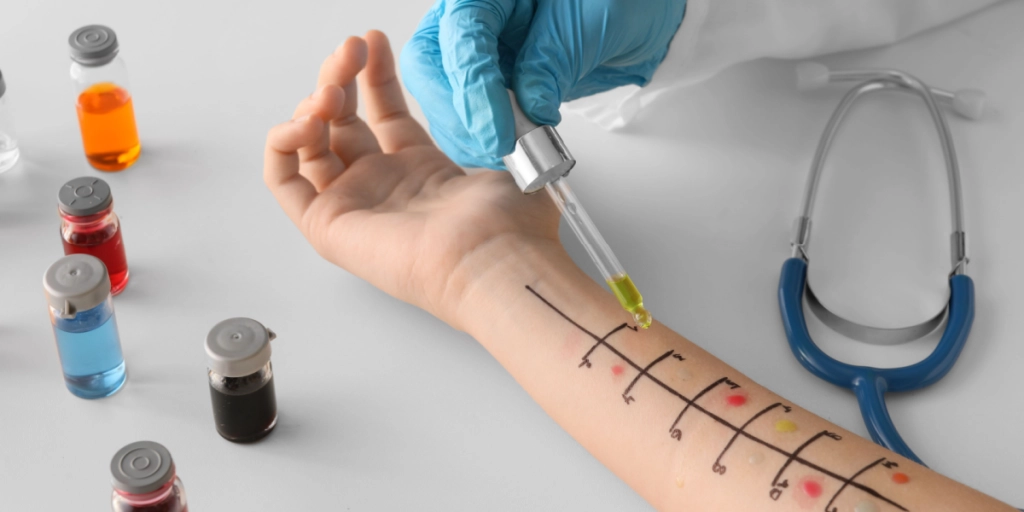 Allergy test