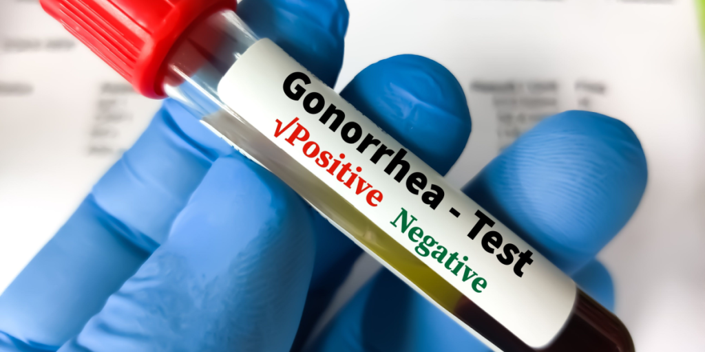 Gonorrhoea test