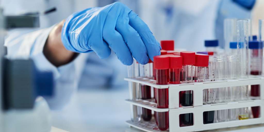 Scientist, blood sample