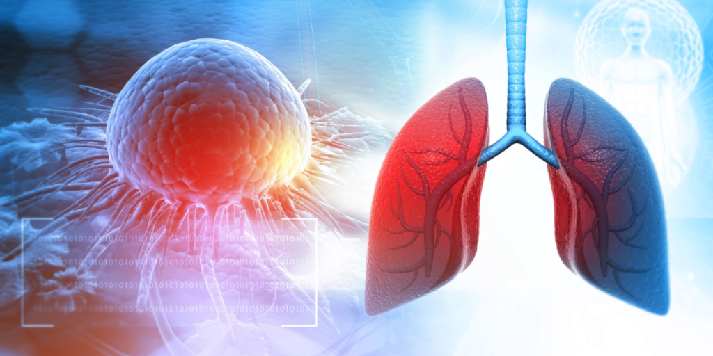 Cancer, lung