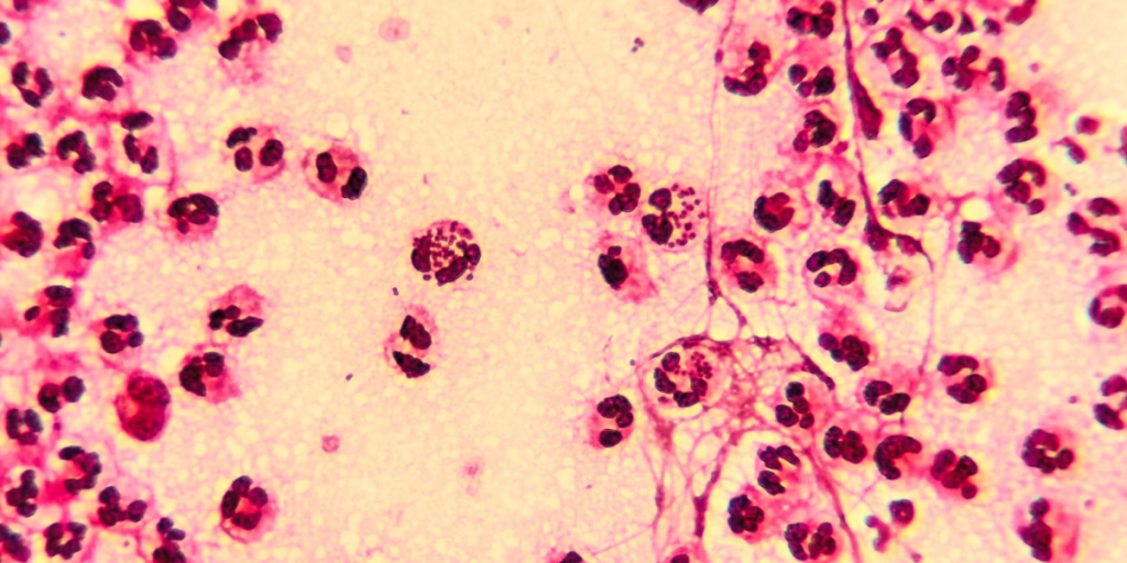STD, gonorrhoea
