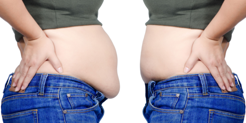 Weight Loss