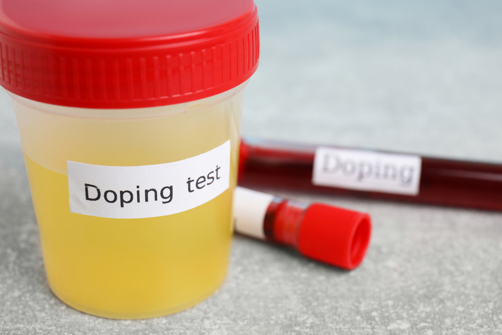 Jar,Of,Urine,Doping,Test,
