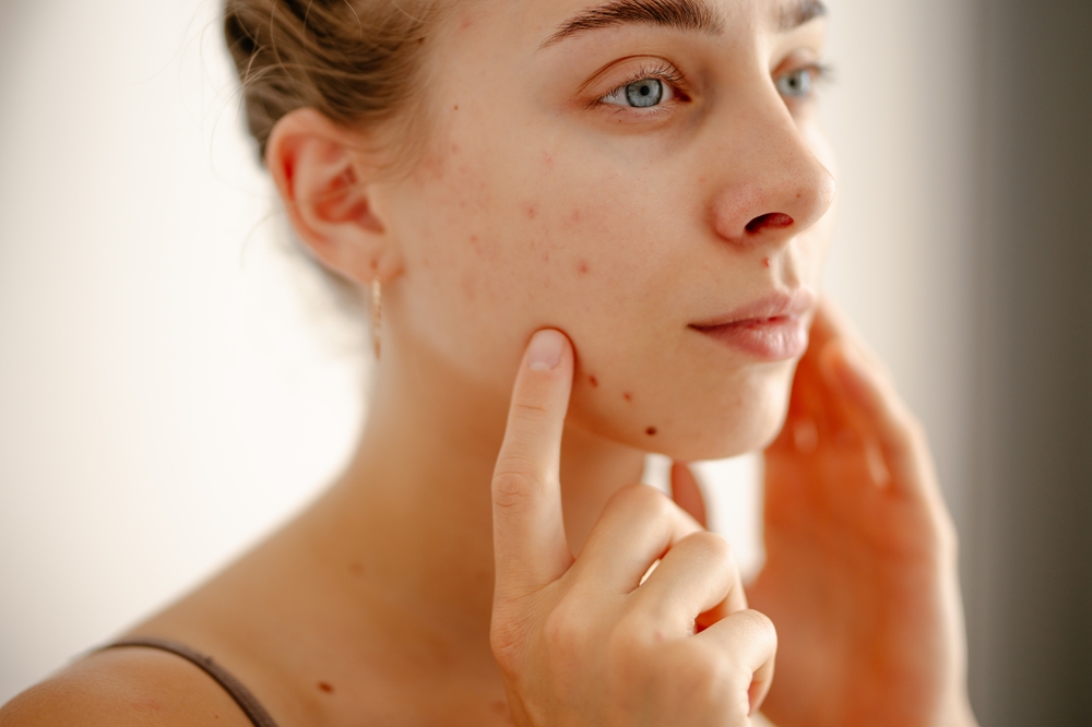 Woman,Face,skin