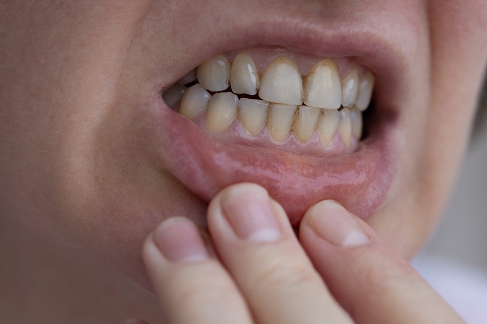 Woman,teeth,kvinde,tænder