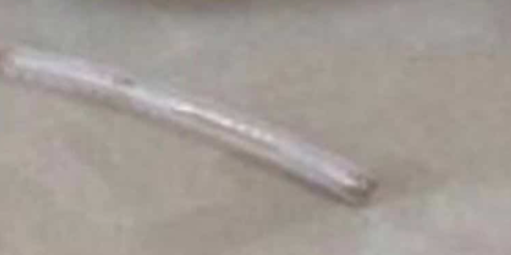 Fiskeben, Fish bone