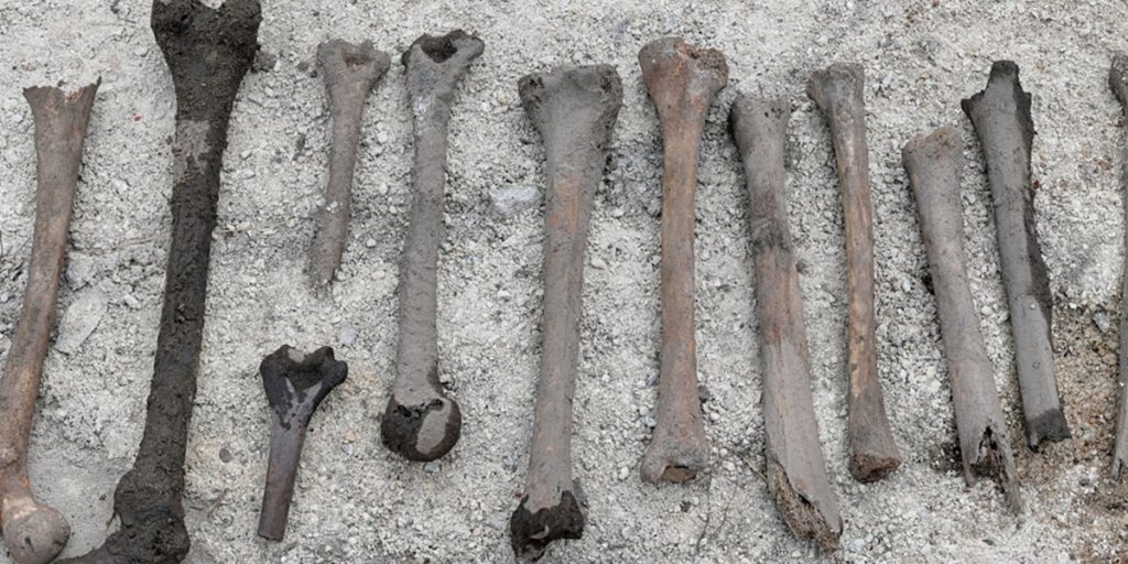 Old,Human,Bones,Dug,Up,During,Exhumation.