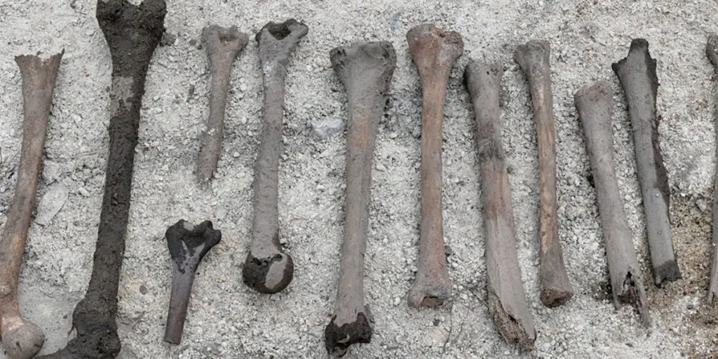 Old,Human,Bones,Dug,Up,During,Exhumation.