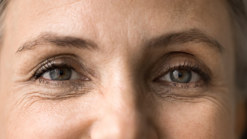 eyes,wrinkles,øjne,rynker