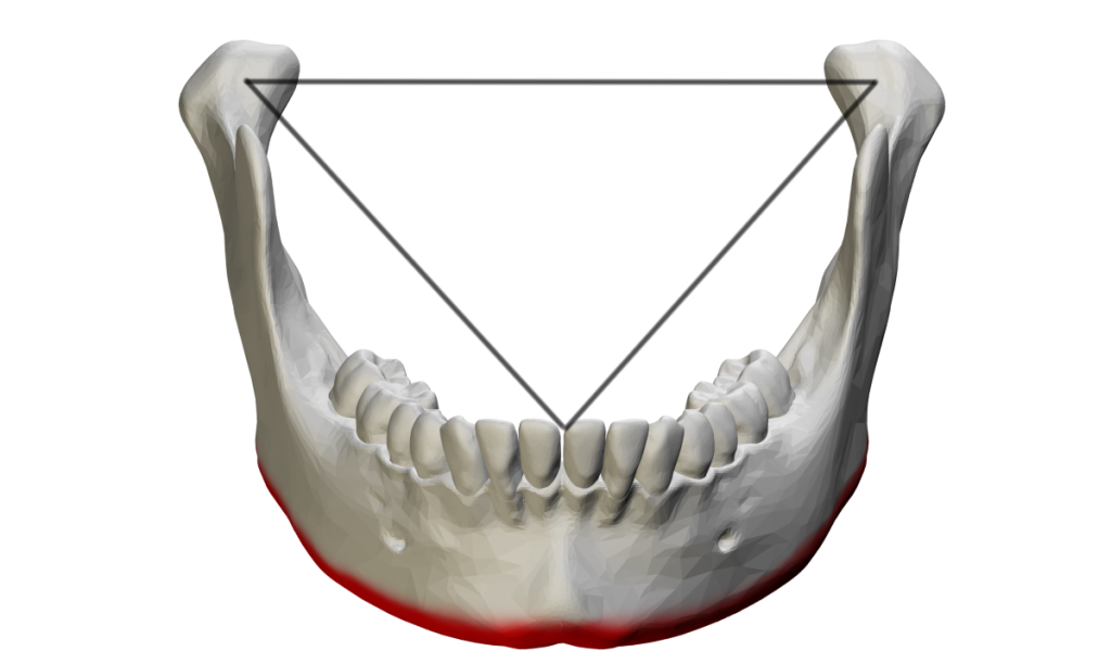 Bonwill triangle