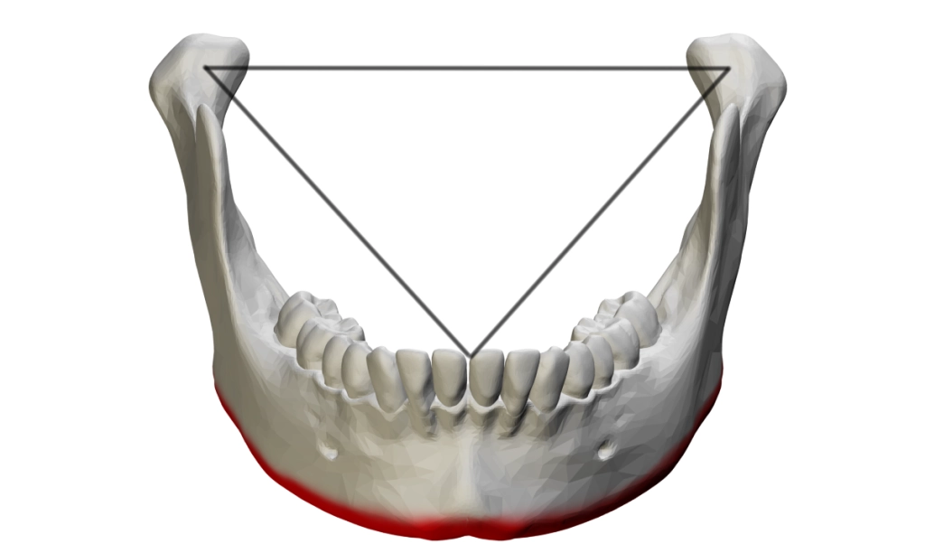 Bonwill triangle
