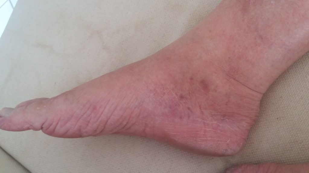 foot fod