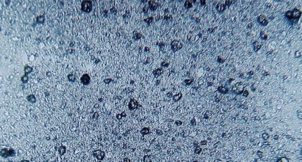 microplastic