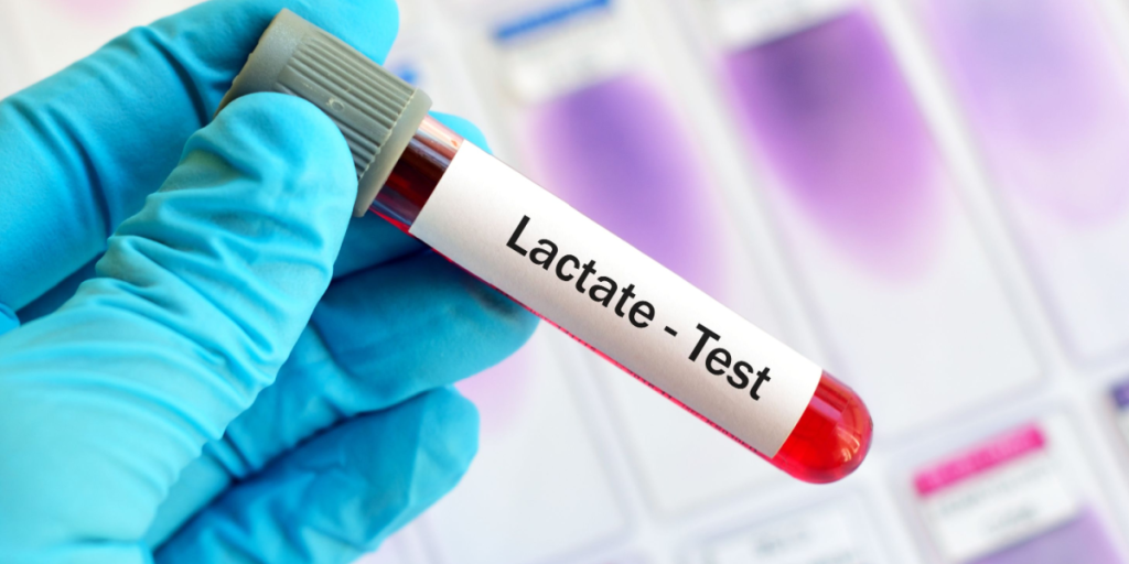 Lactate test