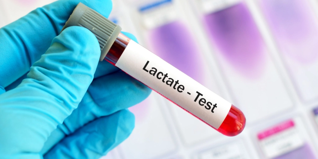 Lactate test