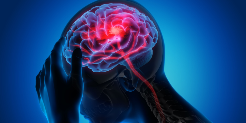 Stroke, brain, health