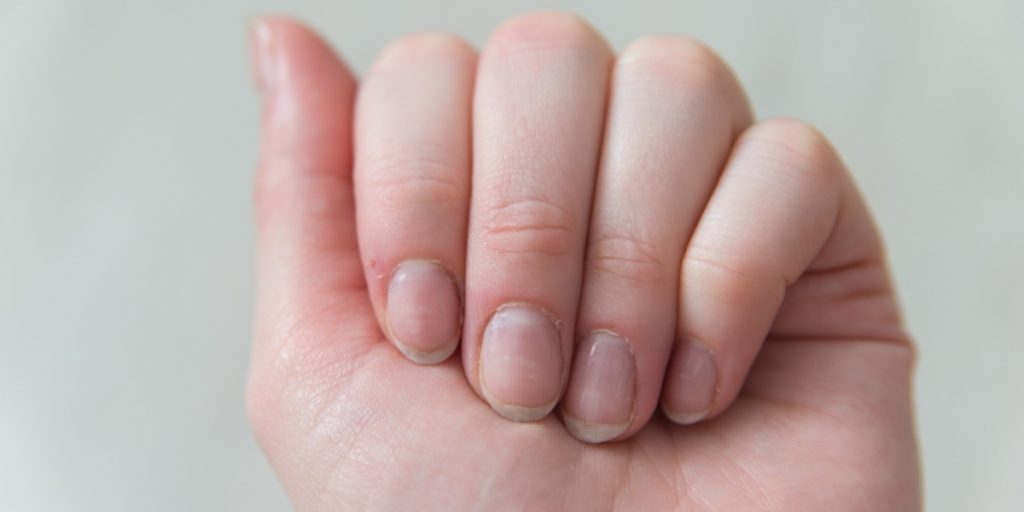 Hånd, negl, finger, hand, nail, finger