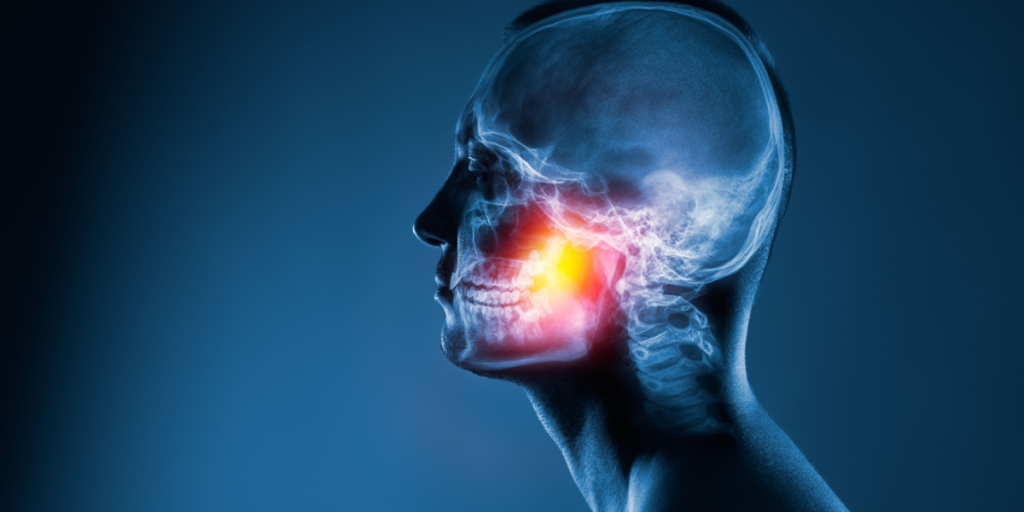 Xray, jaw, broken, pain
