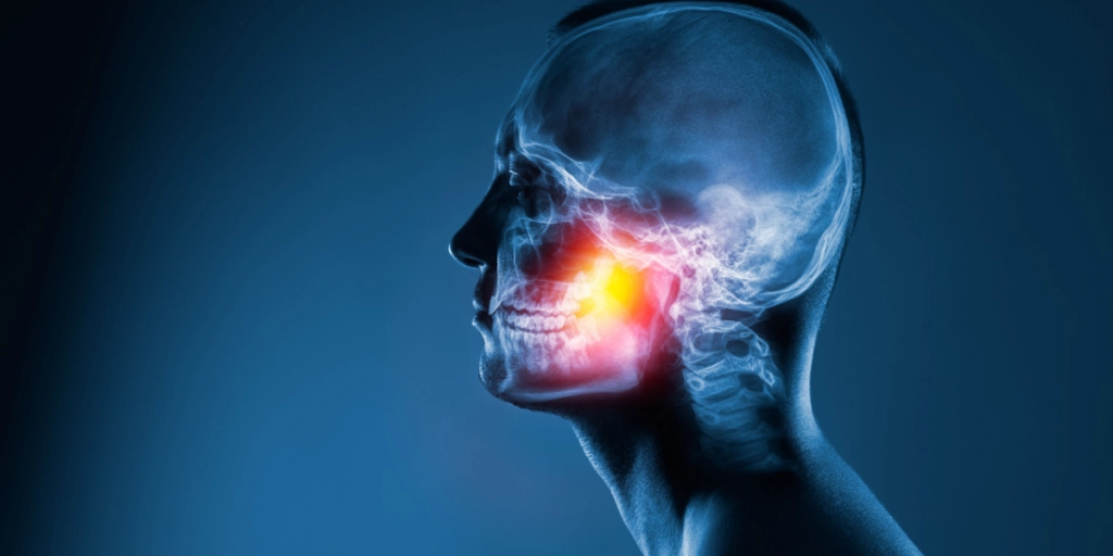 Xray, jaw, broken, pain