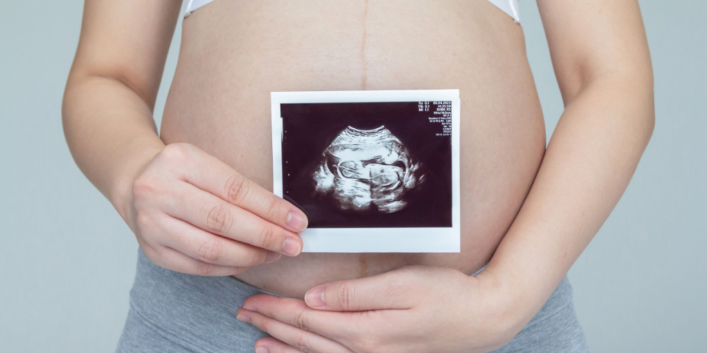 Pregnant, ultrasound