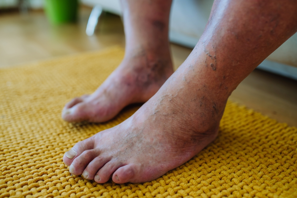 Foot,fod