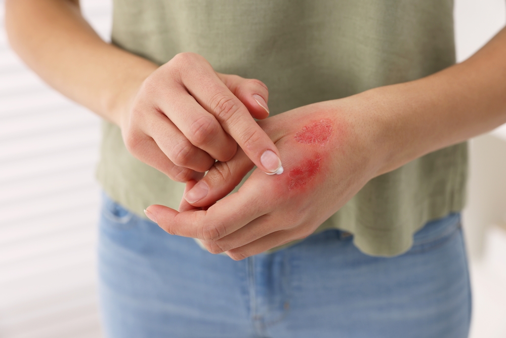 hurt,hand,såret,hånd