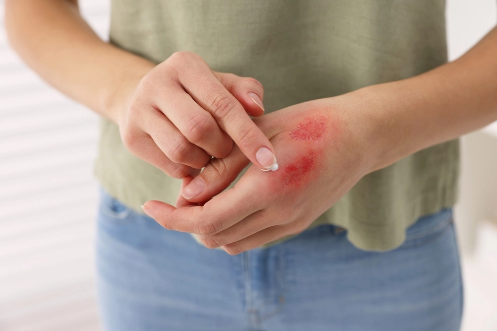 hurt,hand,såret,hånd