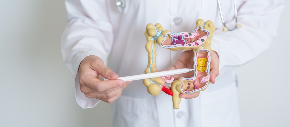 Doctor,Holding,Human,Colon,Anatomy,Model.,Colonic,Disease,,Large,Intestine,