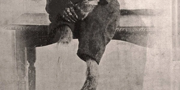 Jackie, the Baboon, amputed leg