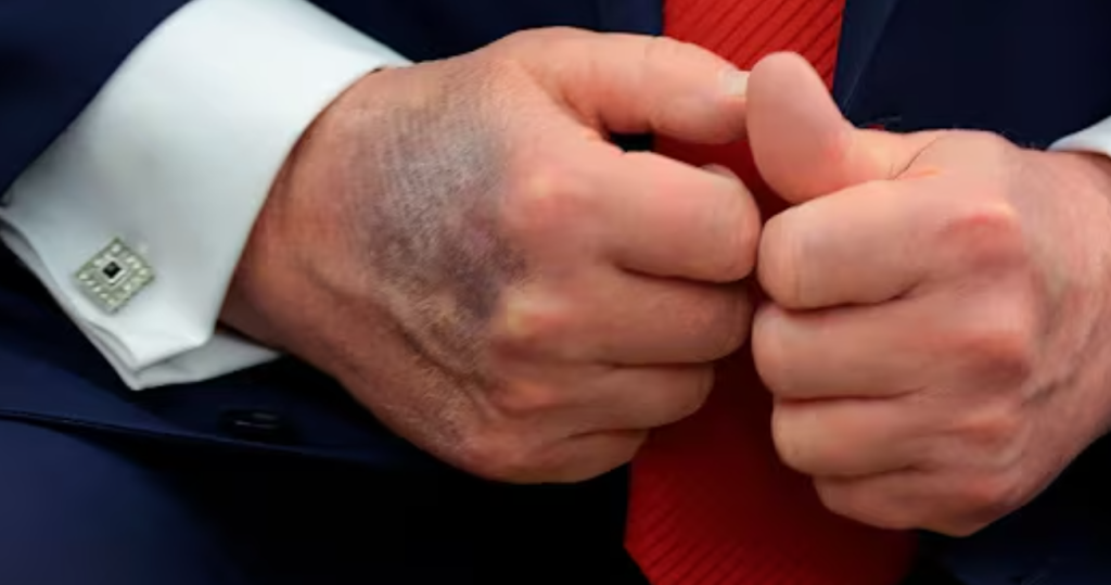 Donald Trump hand