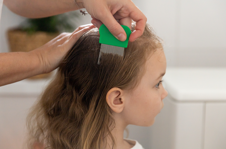 lusejagt, lumekam, lus, lice, hair