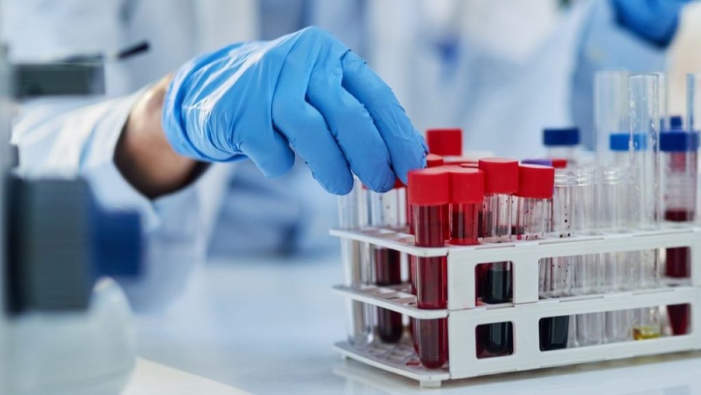 forskning laboratorie blod prøver DNA