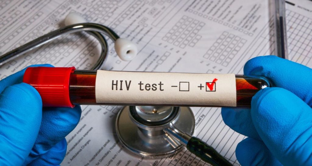 hiv aids
