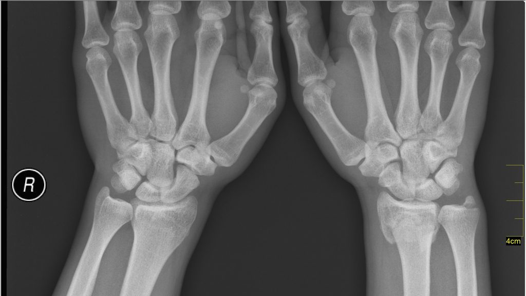 Medical X-Ray imaging