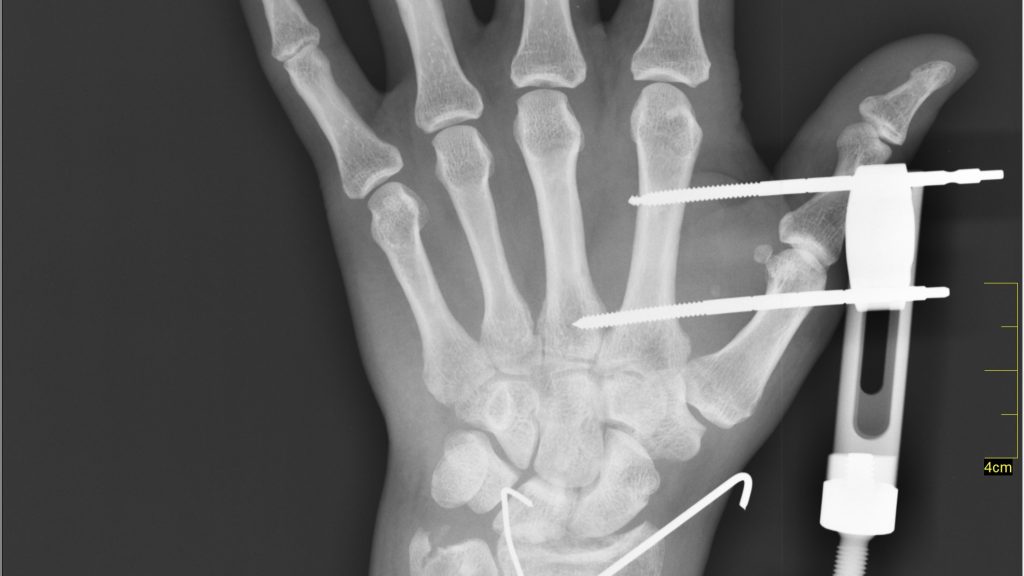 Medical X-Ray imaging