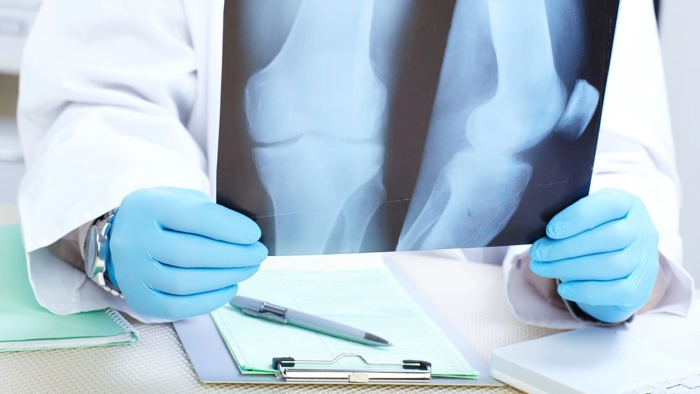 x-ray