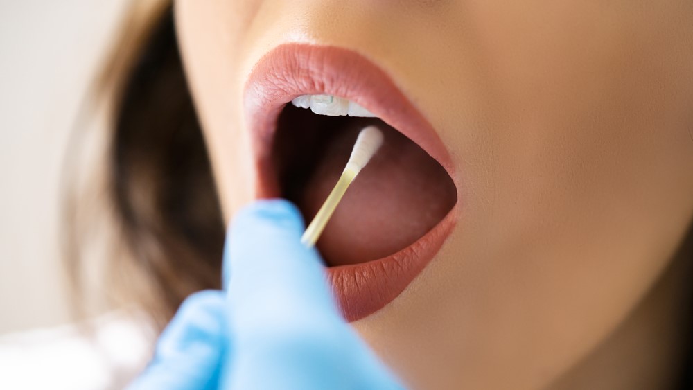 mouth mund dna test