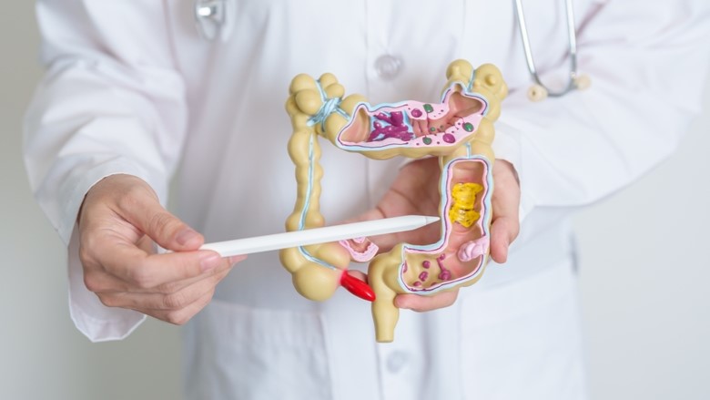 Gastroenteritis, abdominal pain, Bowel cancer
