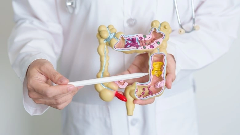 Gastroenteritis, abdominal pain, Bowel cancer