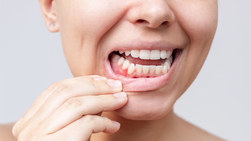 mouth mund teeth tænder