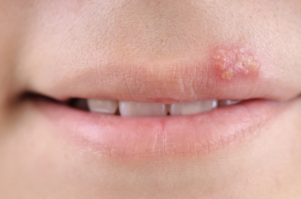 lips, l&aelig;ber