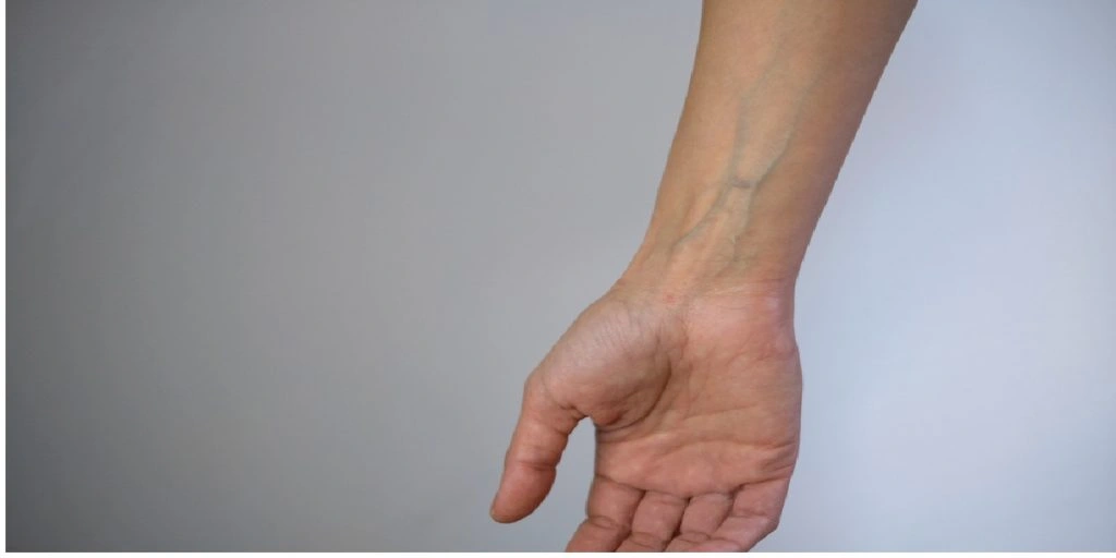 wrist arm man