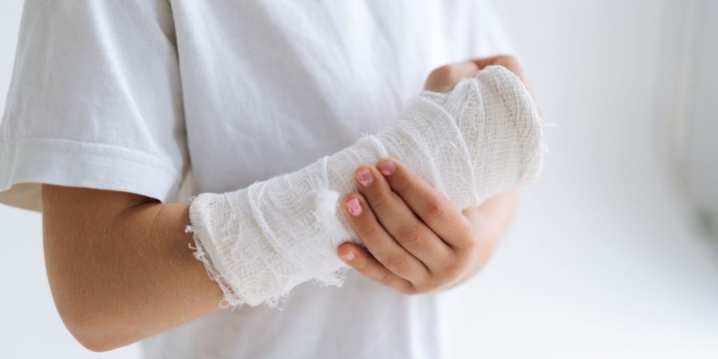 fraktur, fracture, brækket, broken, arm
